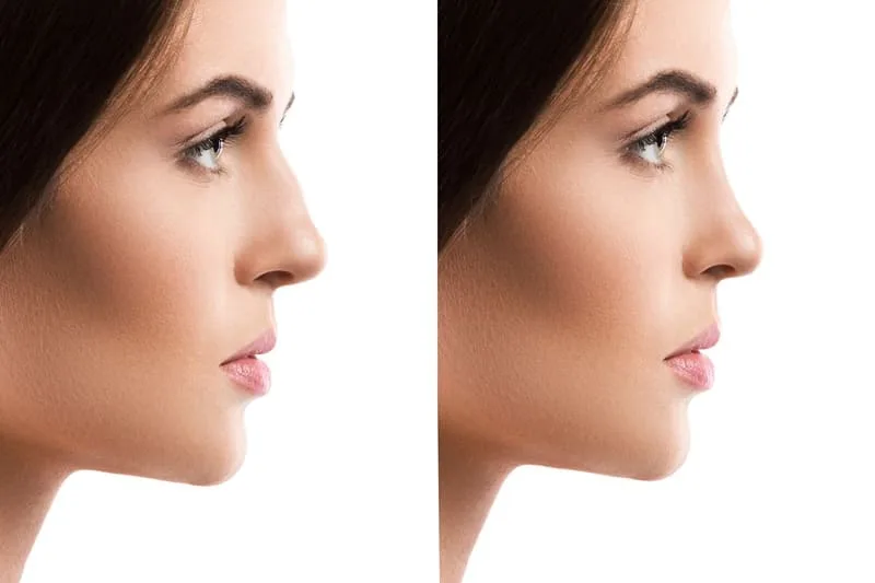 ¿Qué especialista trata las deformidades faciales congénitas?